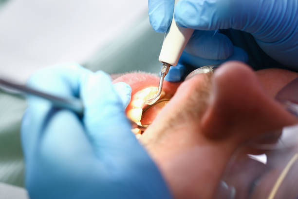 Best Emergency Treatment for Toothache in Morocco, IN