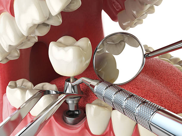 Best Emergency Orthodontic Repairs in Morocco, IN